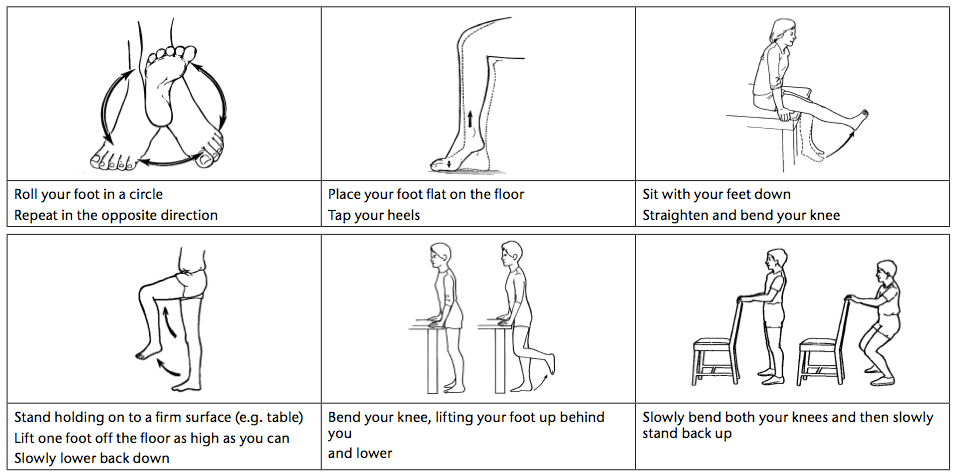 Exercises for lower limb lymphoedema